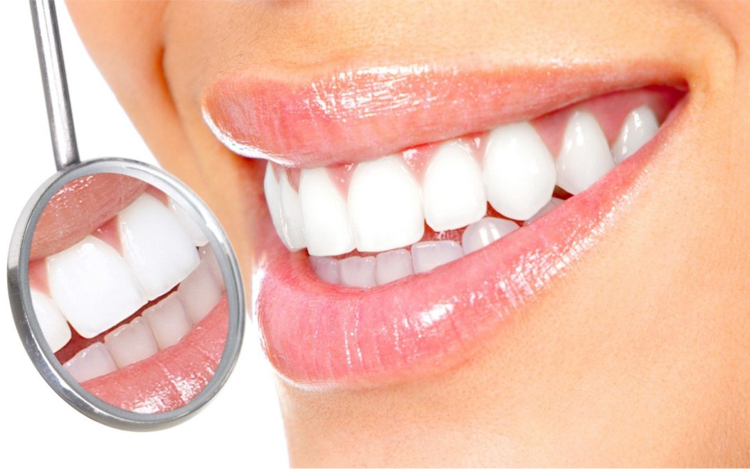 Teeth whitening